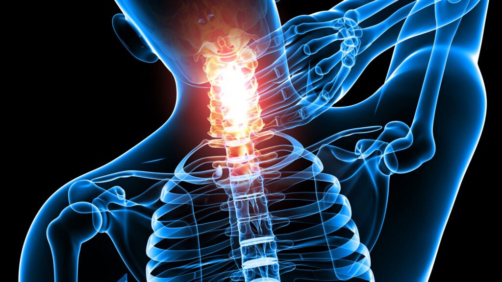 The Cervical Dystonia Market will grow high due to Rising Prevalence of Neurological Disorders