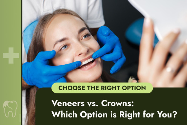 Veneers vs. Crowns: Which Option is Right for You?