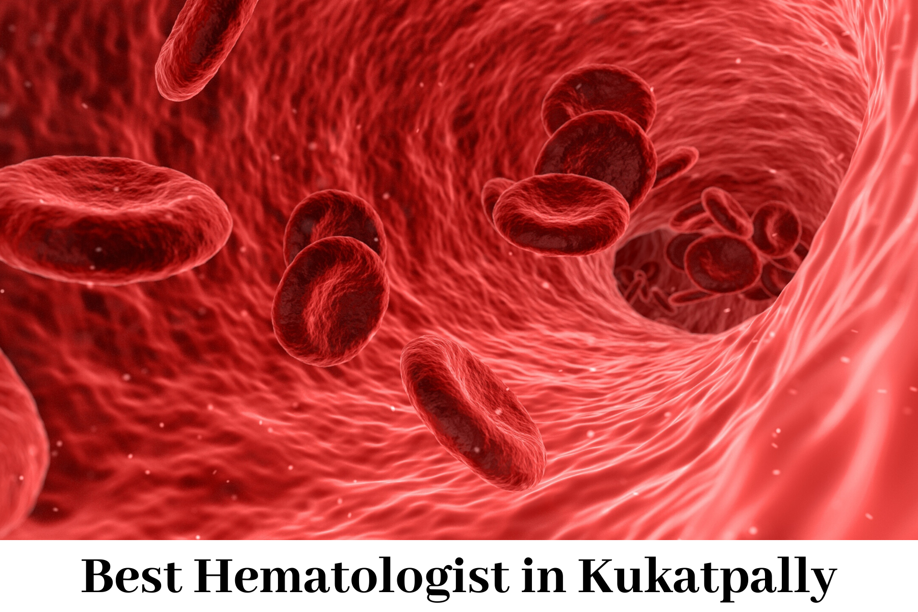 Best Hematologist in Kukatpally