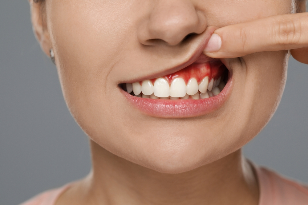 What Are the Early Warning Signs of Gum Disease You Shouldn’t Ignore? 