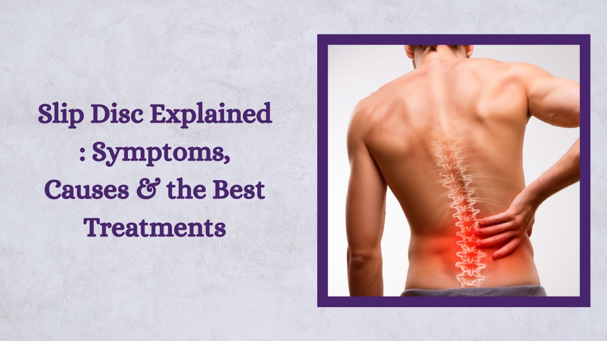 Slip Disc Explained: Symptoms, Causes & the Best Treatments