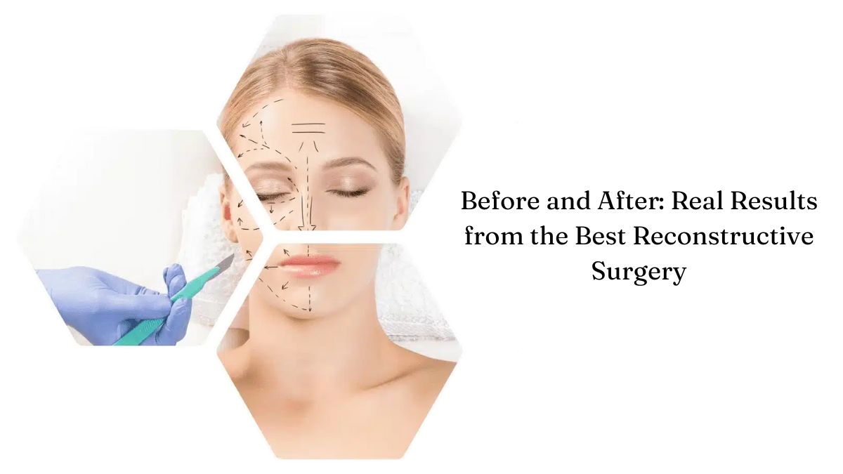 Before and After: Real Results from the Best Reconstructive Surgery