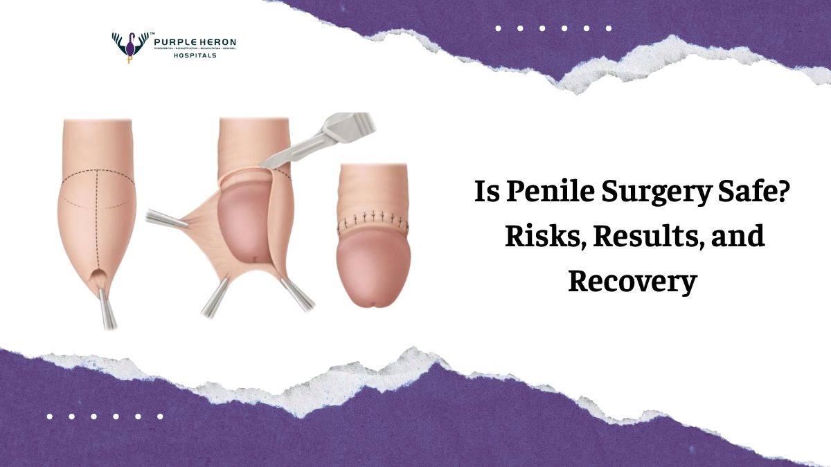 Is Penile Surgery Safe? Risks, Results, and Recovery