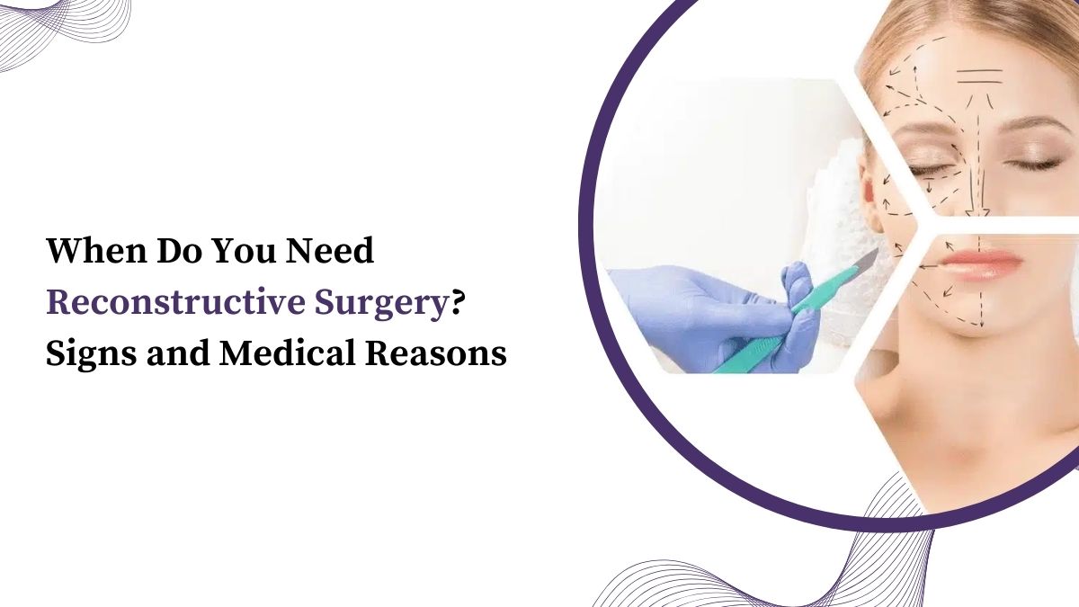 When Do You Need Reconstructive Surgery? Signs and Medical Reasons