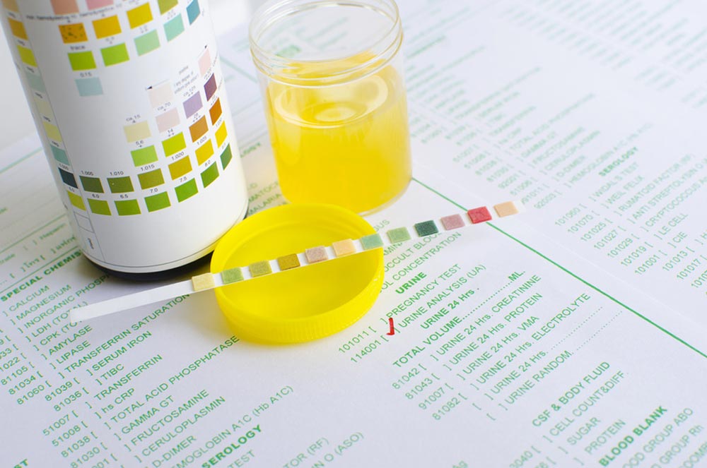 The Most Reliable Synthetic Urine Brands You Should Consider for Drug Testing