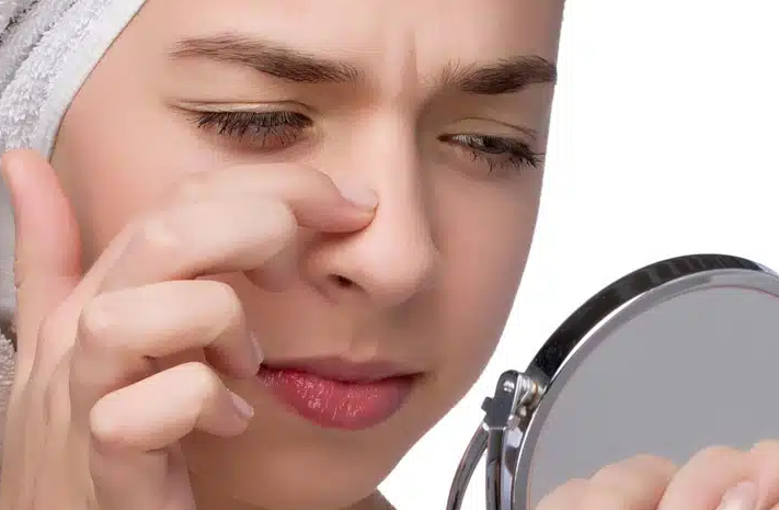 Rhinoplasty in Dubai: Key Recovery Steps