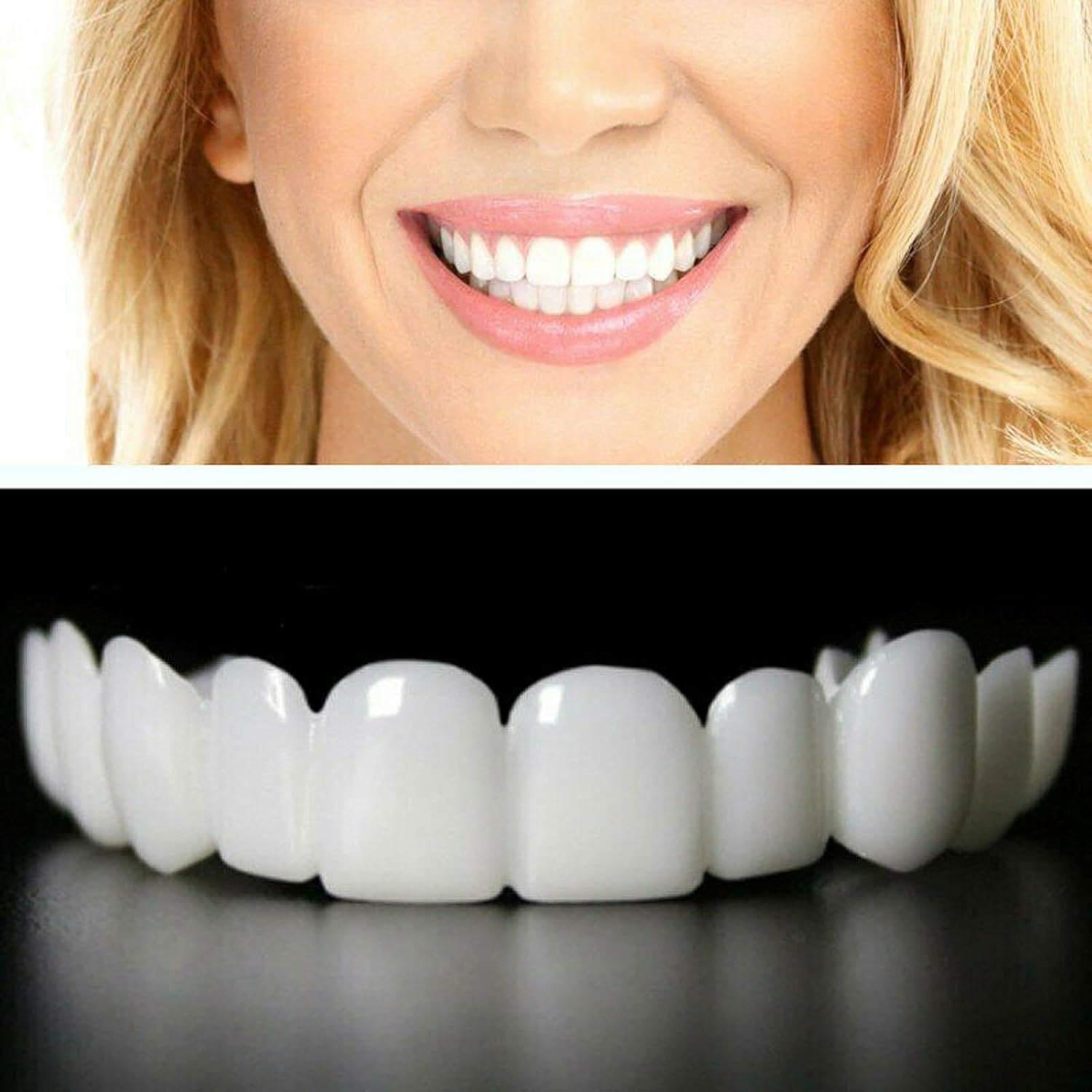 How Long Do Dental Veneers Last in Dubai Clinics?