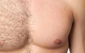 Hair Removal Method with Laser Safe & Quick