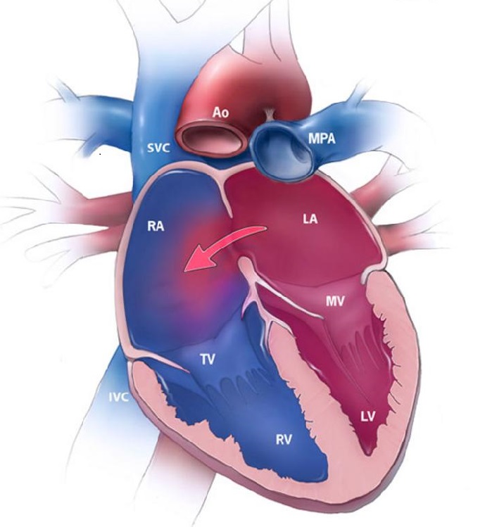 Cardiology Treatment in Rohtak
