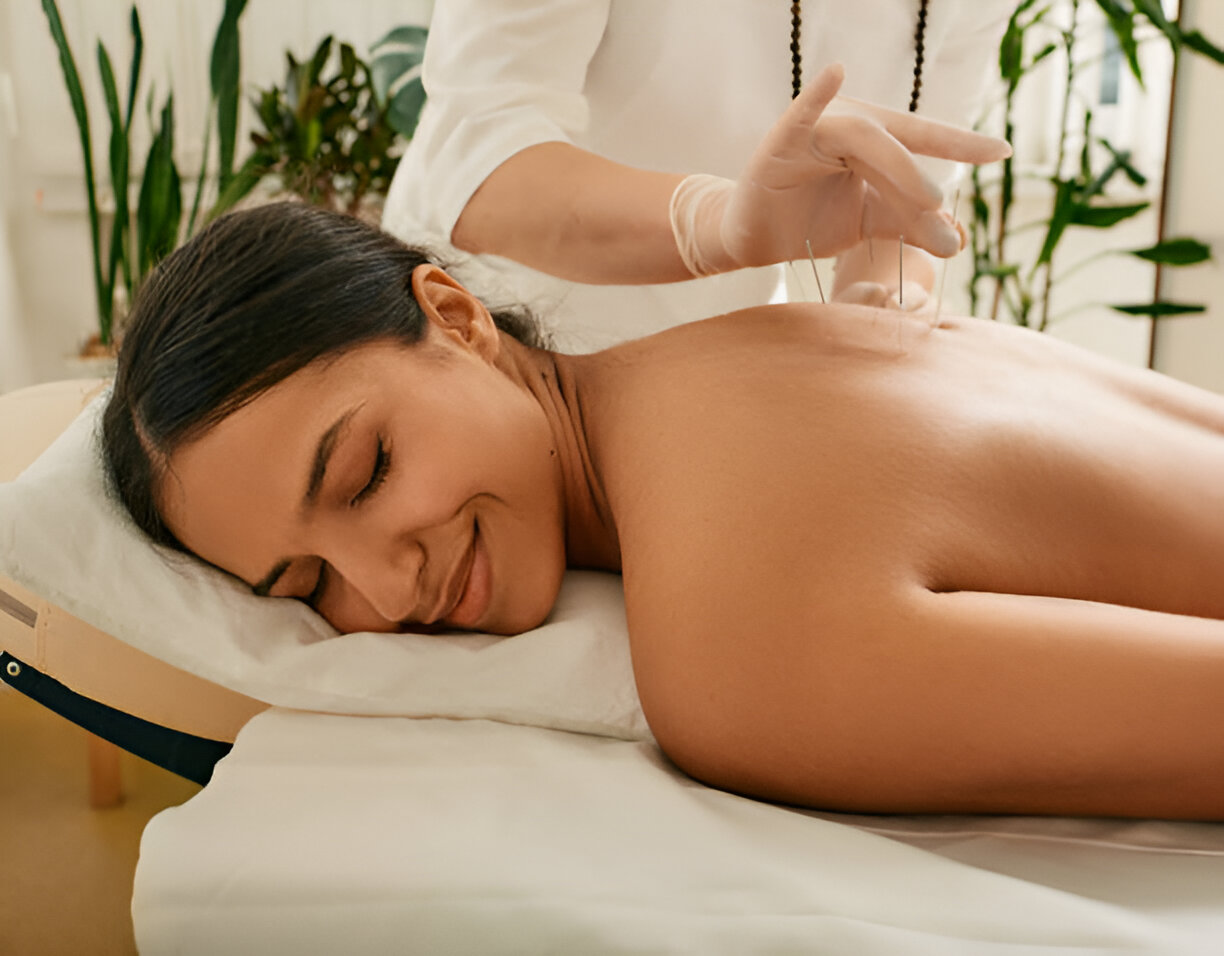 Why Acupuncture Is Gaining Popularity in Edmonton’s Wellness Community