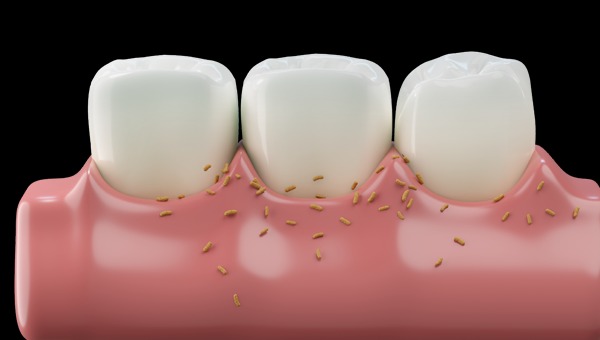 dental implant service Puchong