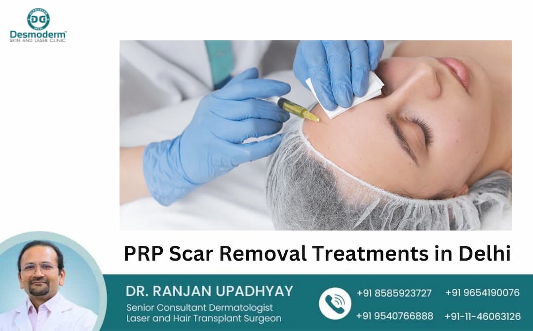 Revitalize Your Skin: PRP Scar Removal Treatments in Delhi