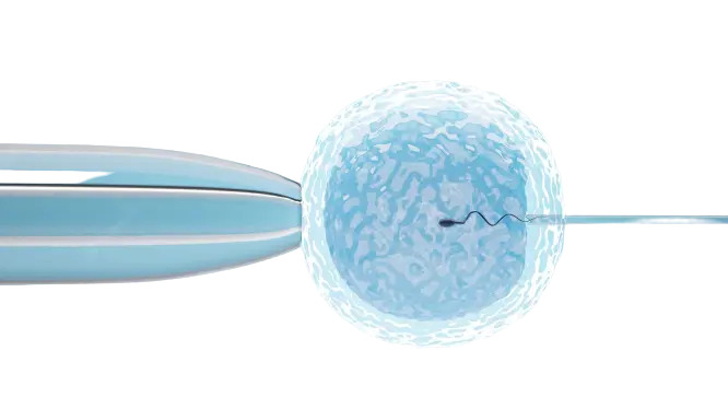 Advanced IVF and ICSI Treatments for Male Infertility in Hyderabad