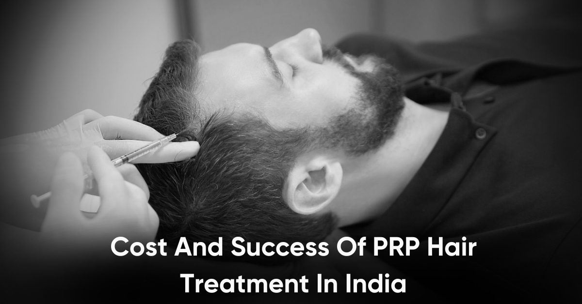 Beard Transplant – Natural-Looking, Permanent Results.