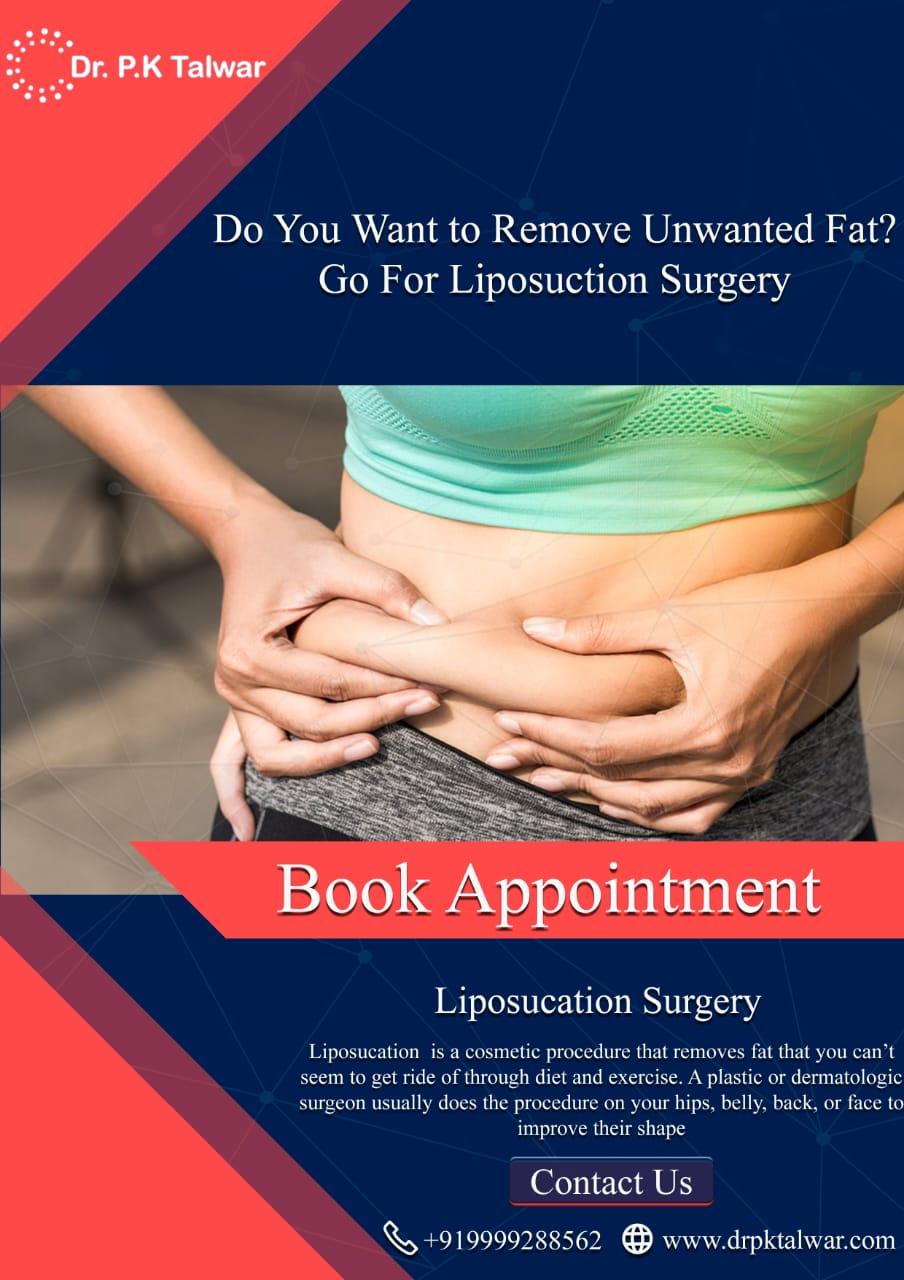 Liposuction surgery in Delhi
