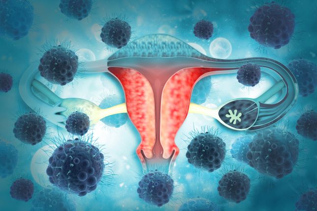  Clear Cell Ovarian Cancer Market Primed for Growth Due to Rising Prevalence 