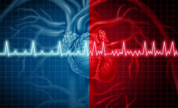 The Pulsed Field Ablation Market is Projected to Grow at a CAGR of 16% Due to Rising Prevalence of Cardiac Disorders
