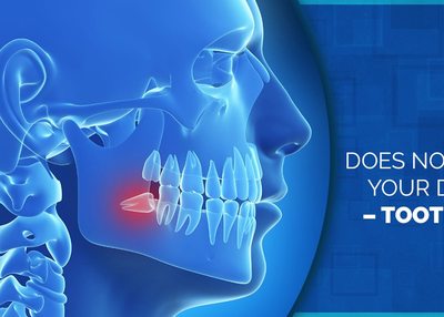 Tooth Impaction Surgery cost in chennai
