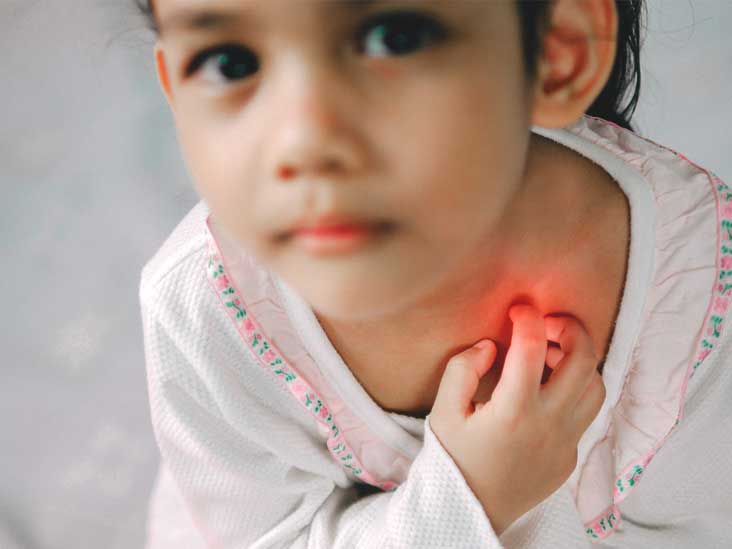 Branchial Cleft Cyst Surgery in India | Healing Touristry