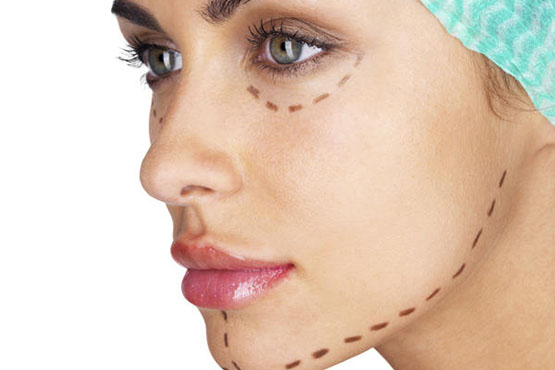 Best Doctors for Facial Implants Surgery in India