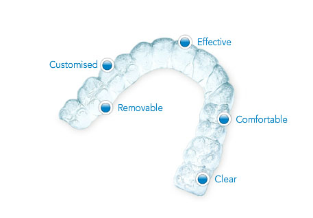 Invisalign Aligners Treatment in India | Healing Touristry