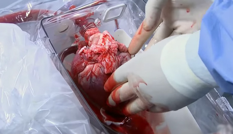 Best Heart Transplant in India | Healing Touristry
