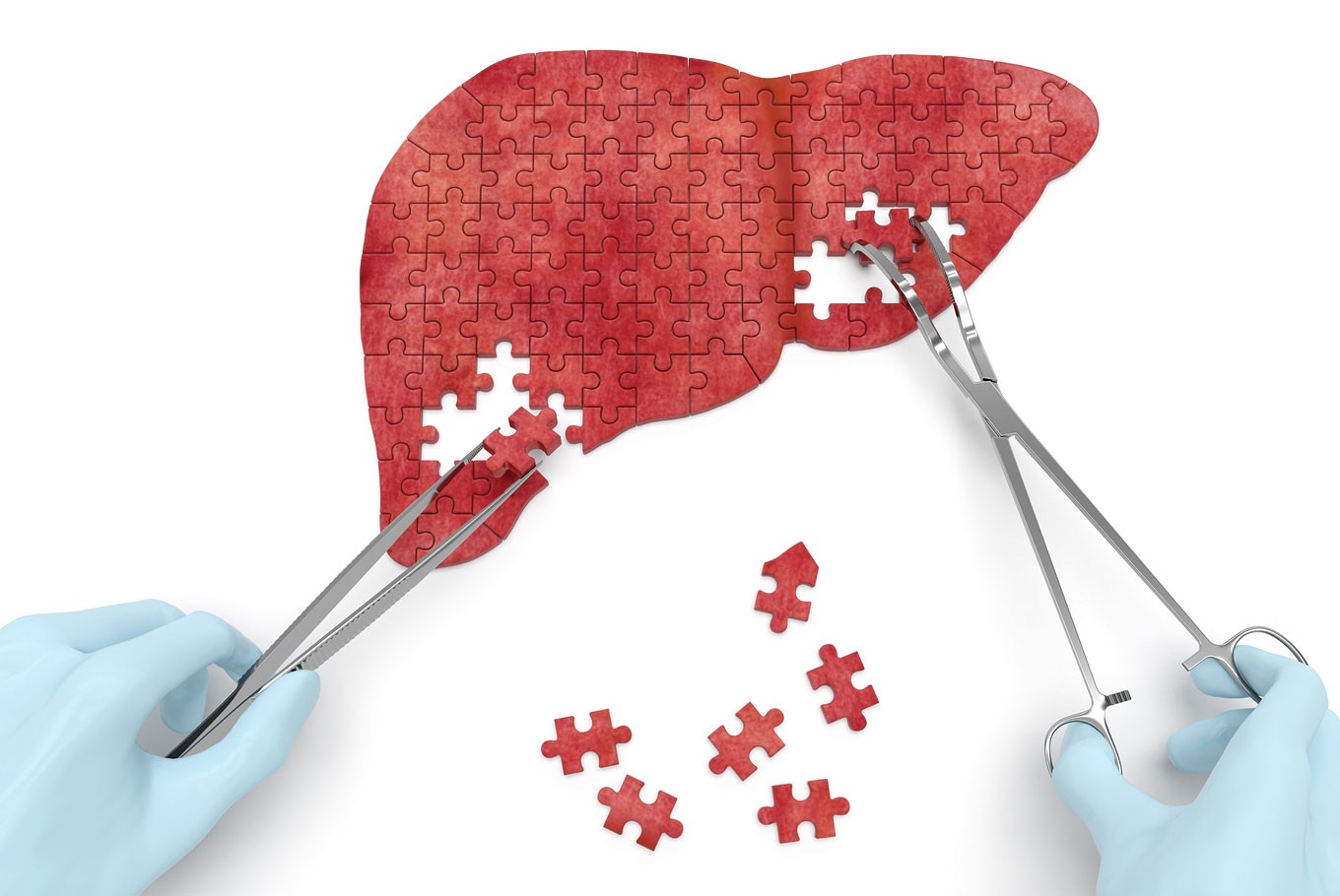 Other Liver Disorders Treatment in India - Healing Touristry