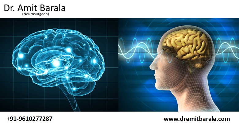 Top Best Neurologist in Jaipur