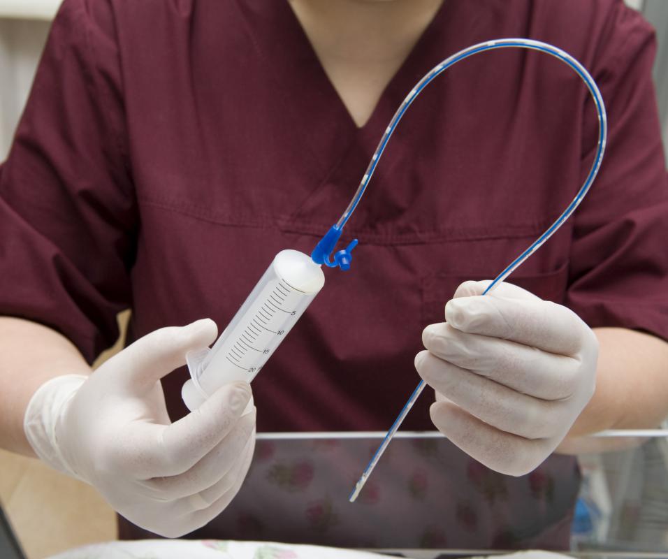 Feeding Tubes Market Expands Rapidly Due to Rising Prevalence of Chronic Diseases and Aging Population