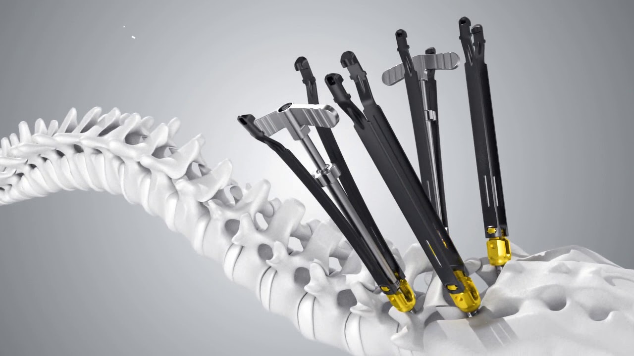 Bone Cement Market Exhibits Robust Growth Due to Rising Orthopedic Surgeries and Technological Innovations
