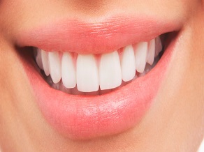 What is a ‘Smile Makeover’ Treatment?