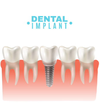 Patients Are Shocked by the Results at This Dental Implant Clinic in Noida