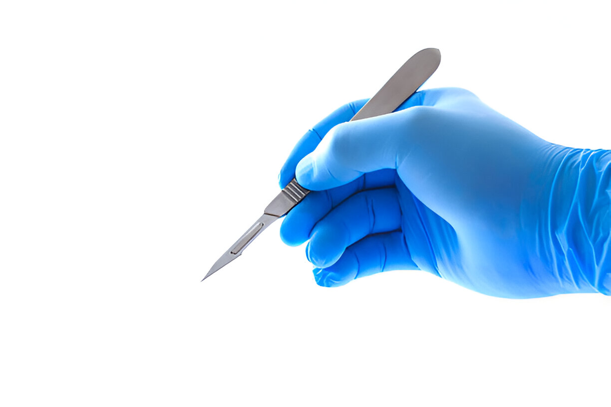 Removing Scalpel Blade from Handle: A Comprehensive Guide