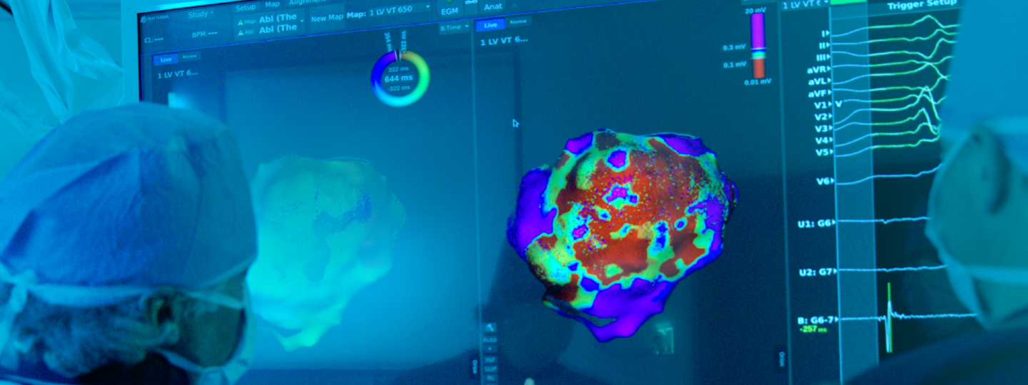Cardiovascular Devices Market Industry Analysis, Size, Share, Trends by 2030