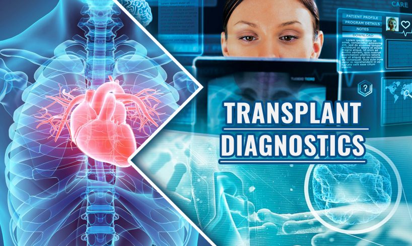 Global Transplant Diagnostics Market Report 2021-2030 | Growth and Trends