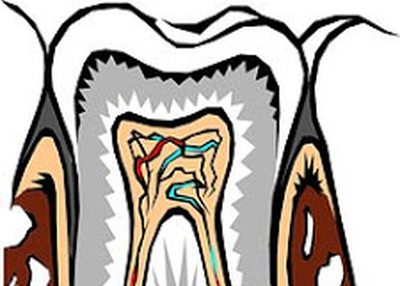 Dental implants San Mateo