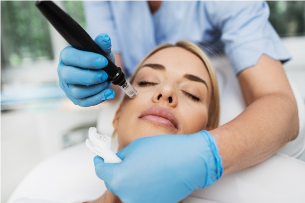  What You Should Know About Microneedling