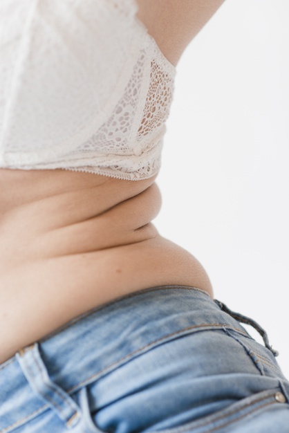 Liposuction in Santa Barbara - Things to Remember When Considering the Cost