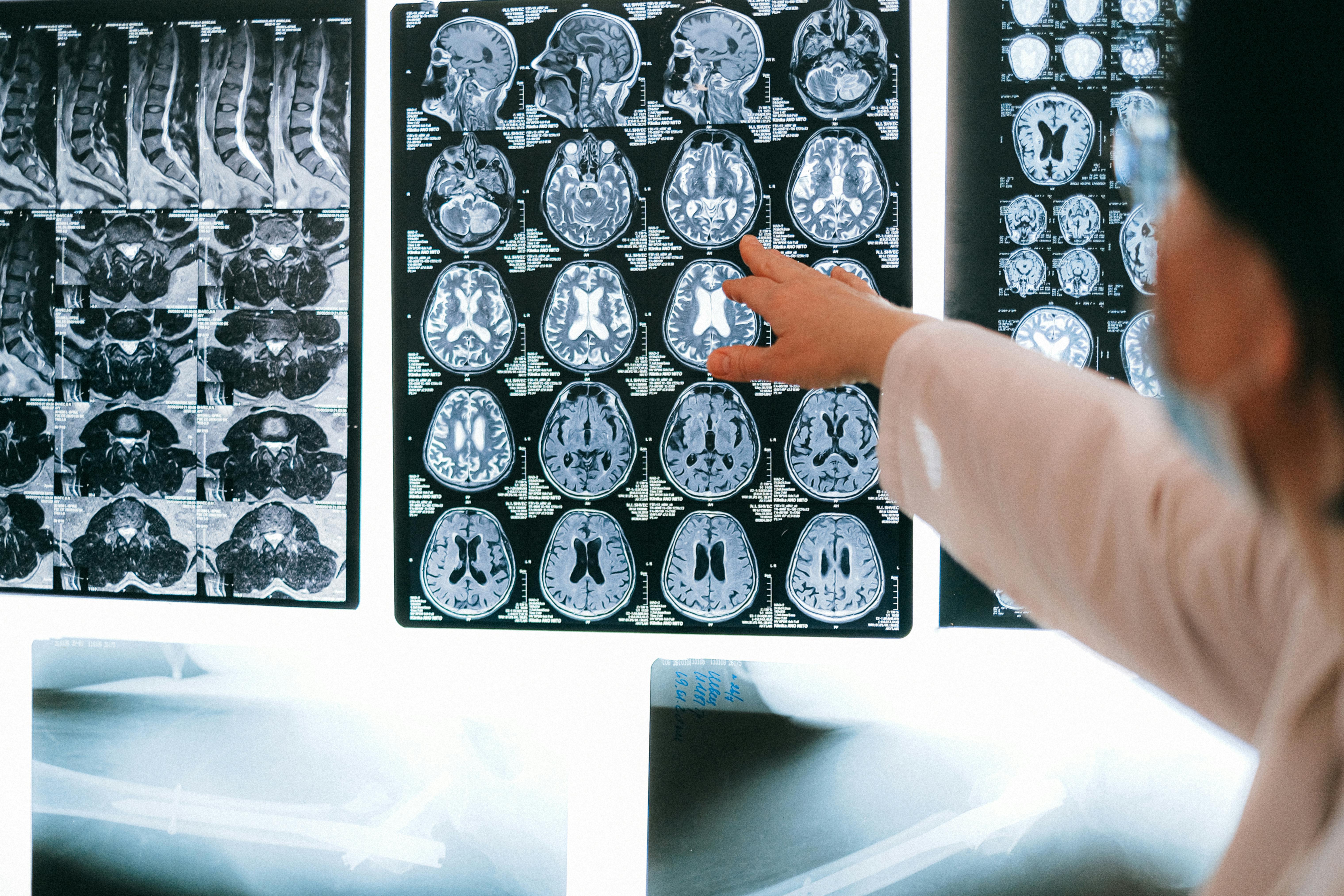 Brain Surgery: Cutting-Edge Techniques for Enhanced Safety