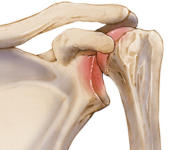Advanced Joint Care That Gets You Moving Again