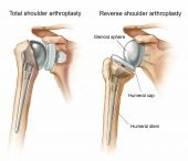 Expert Orthopedic Care for Stronger Bones and Better Mobility